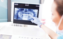x ray smile dental