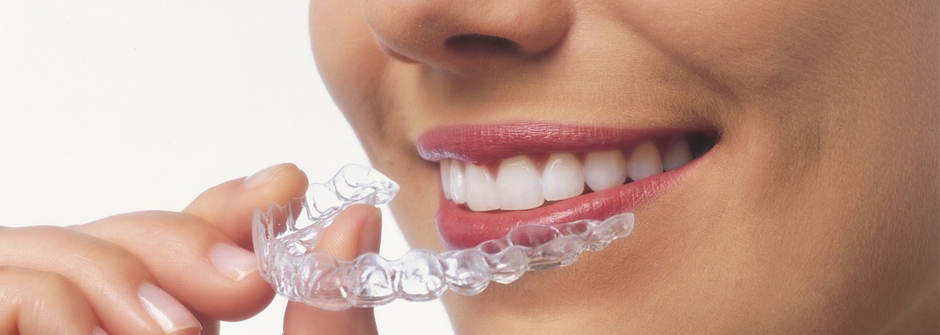 orthodontist invisible braces